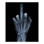 Αυτοκόλλητο Πλακάκι X-RAY