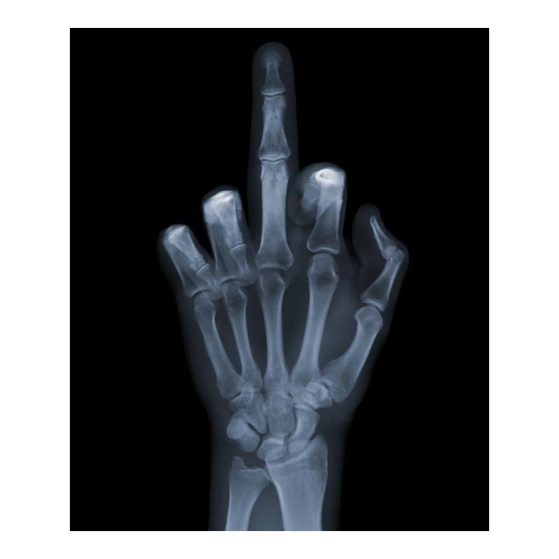 Αυτοκόλλητο Πλακάκι X-RAY